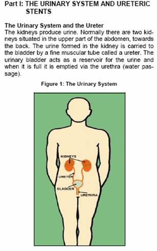 ureteric stent
